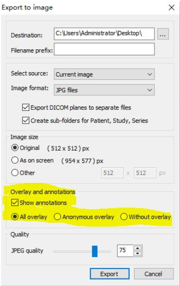 MicroDicom viewer